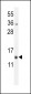 RM51 Antibody (C-term)